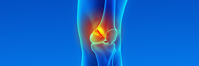 Distal Femur Fracture with Complete ACL Disruption”. A Case Study
                                                and Review of the Literature
